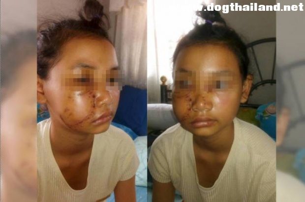เจ้าของหมากัดเด็ก จ่ายค่าเสียหายแค่แสนห้า หลังจากทางด้านพ่อเด็กเรียก 3 แสนค่าทำศัลยกรรมลูกสาว